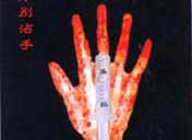 �����ӡ�