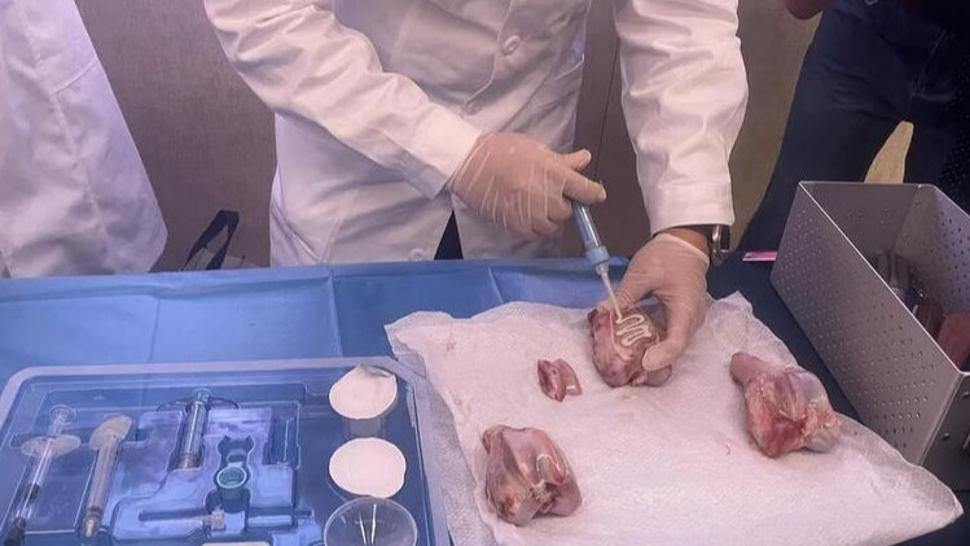 China unveils world's first fast-acting 'bone glue' for fracture repair